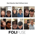 Folifuse Kit