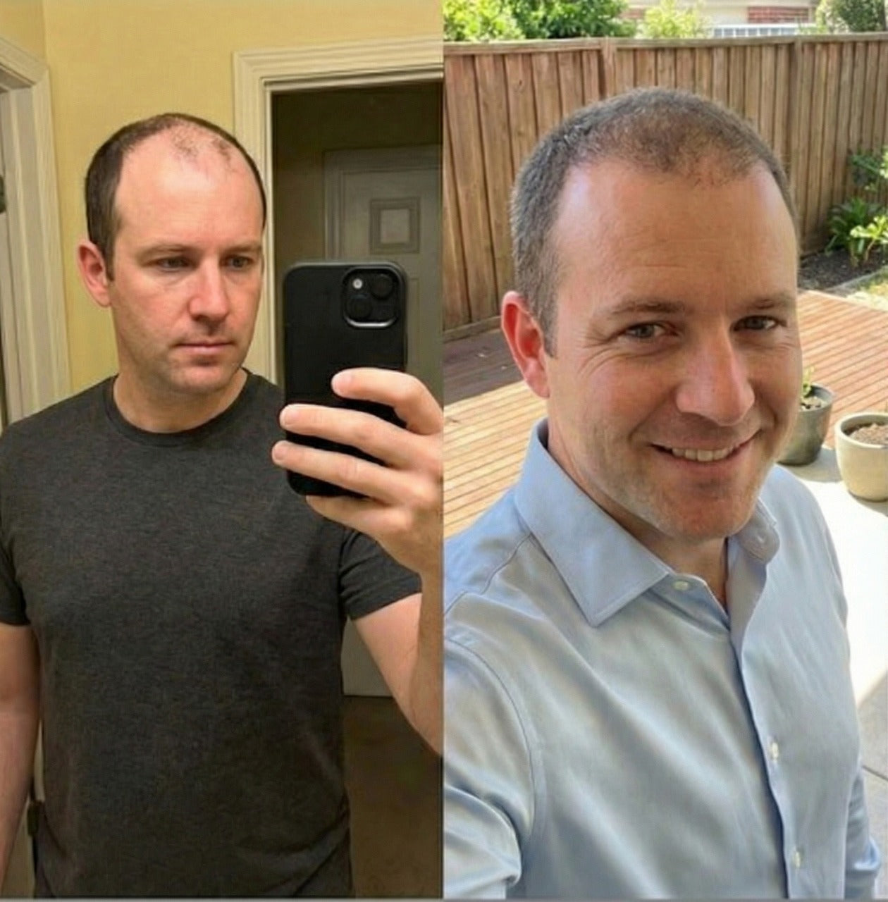 Brandon Walker before and after results