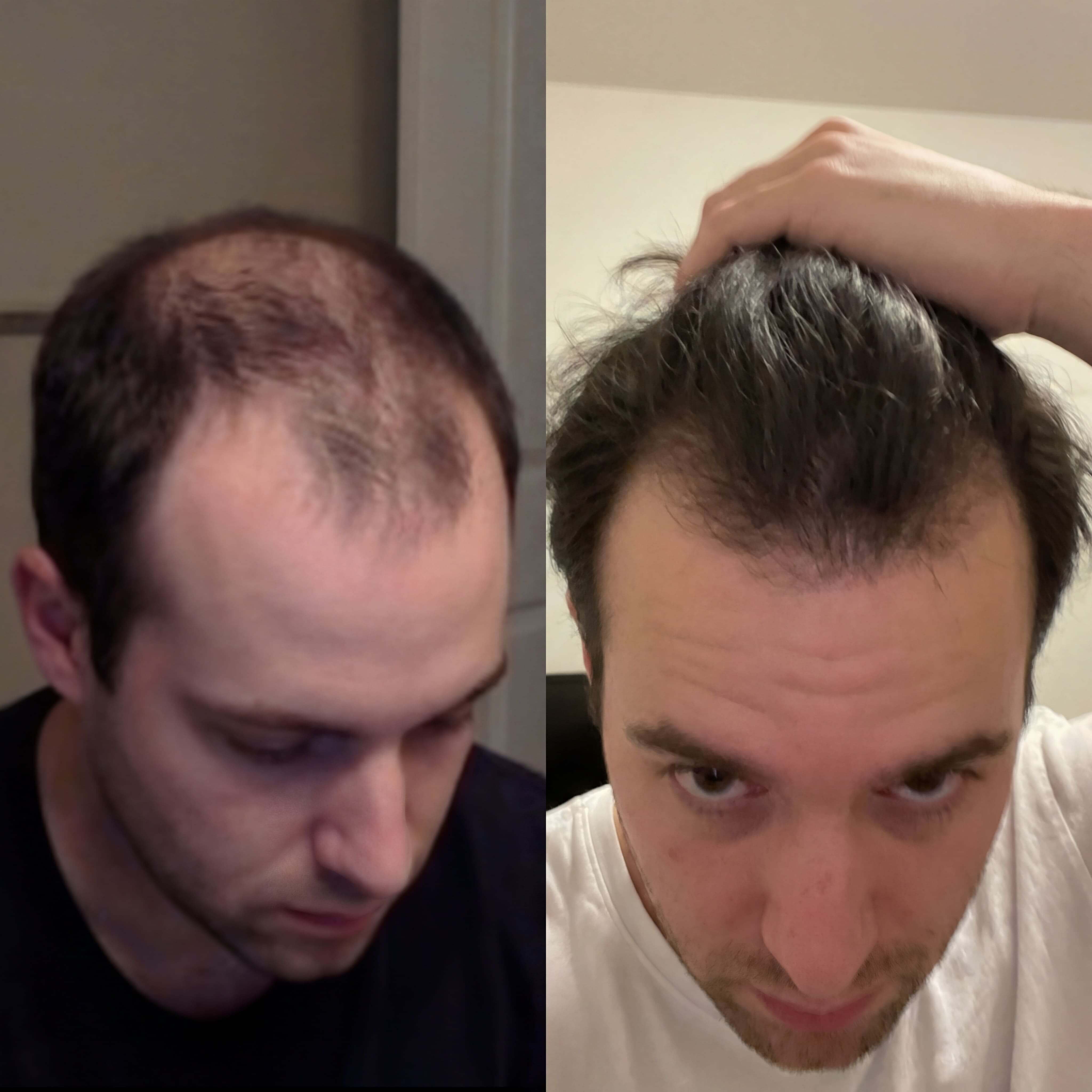 Marcus Reynolds before and after results