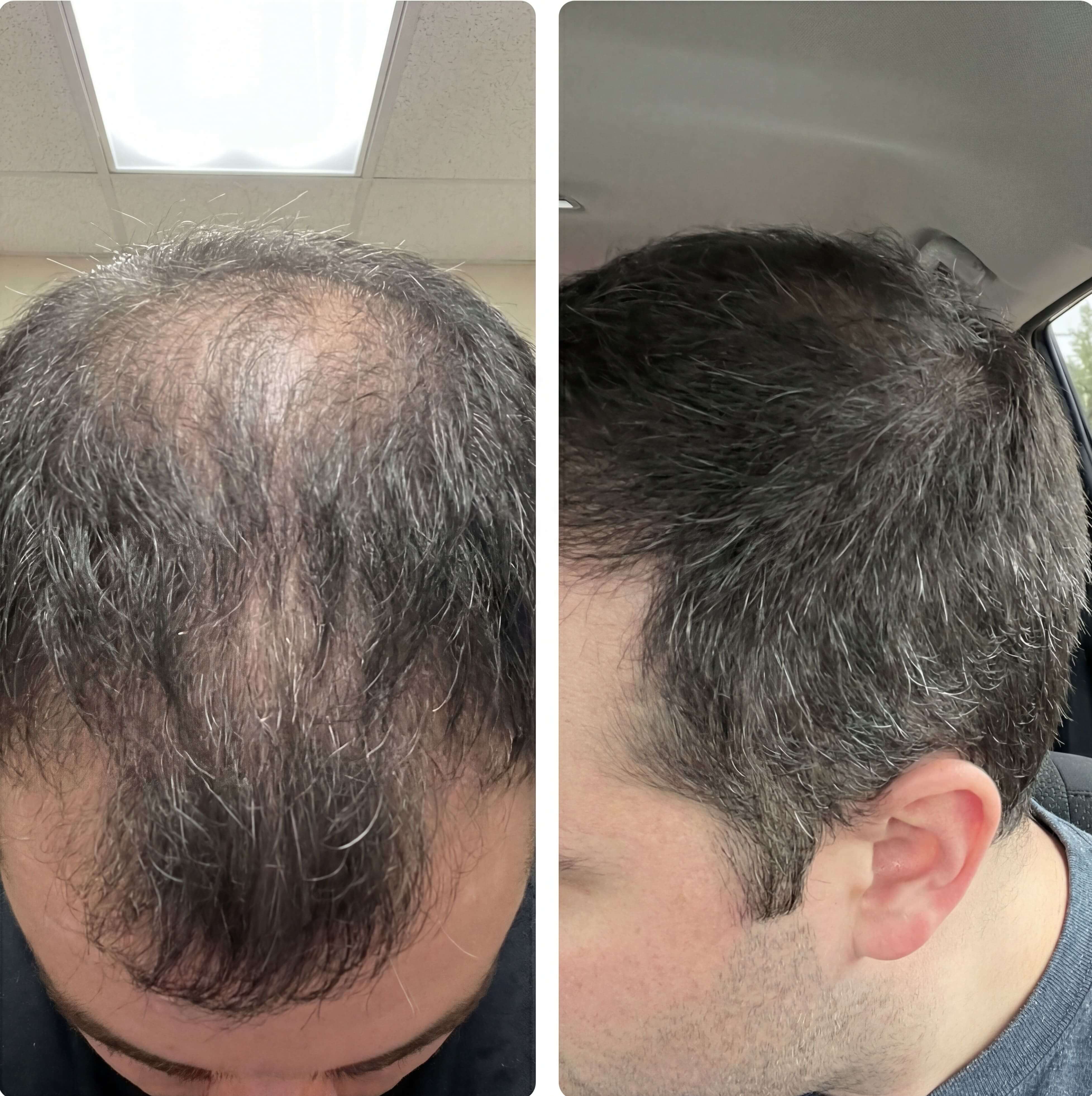 Daniel Park before and after results