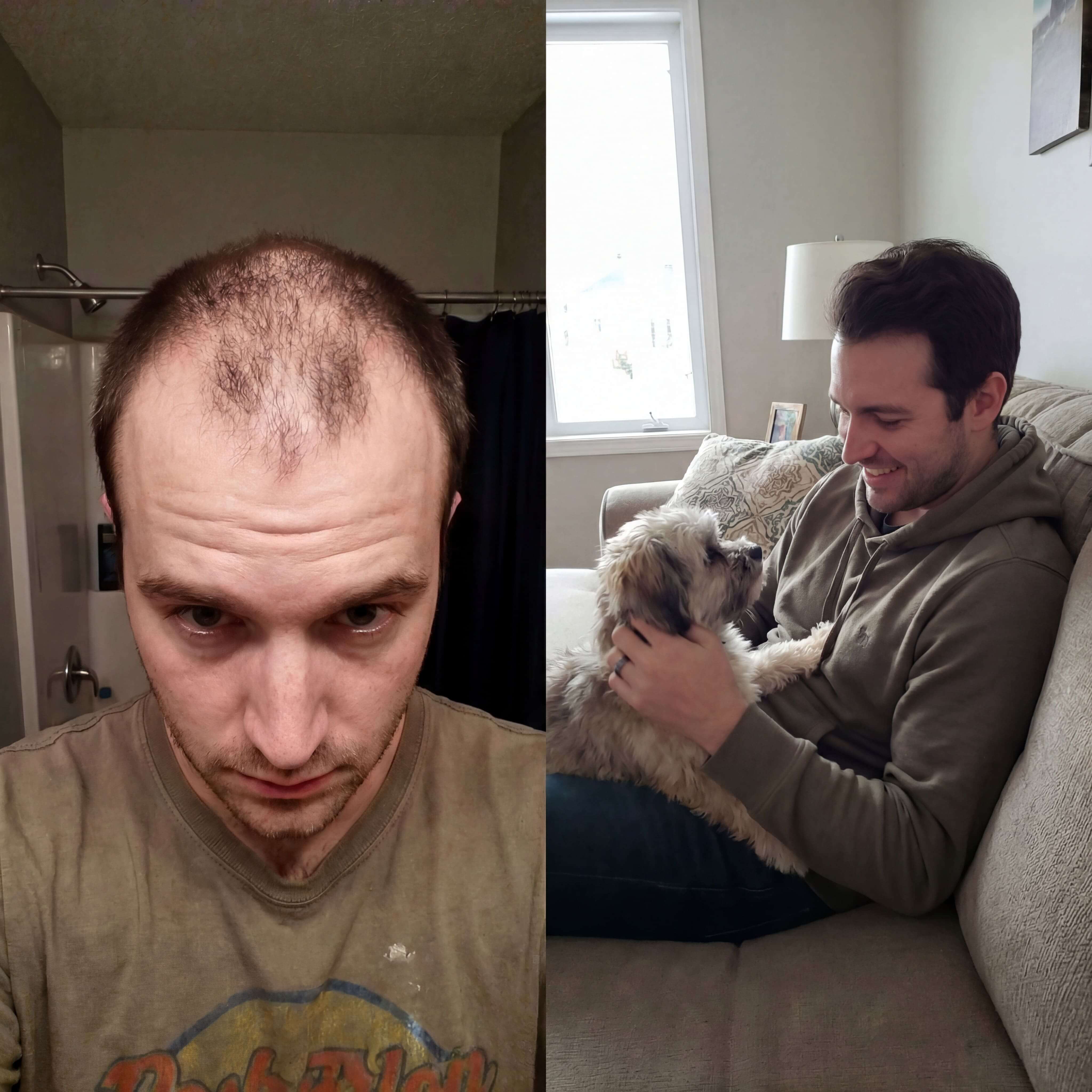 David Miller before and after results